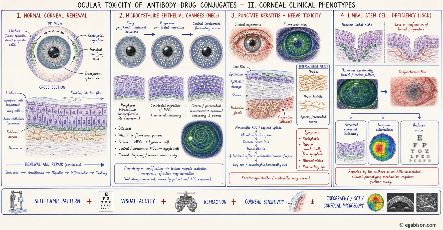 Plate II: corneal clinical phenotypes, from normal renewal to limbal stem cell deficiency.