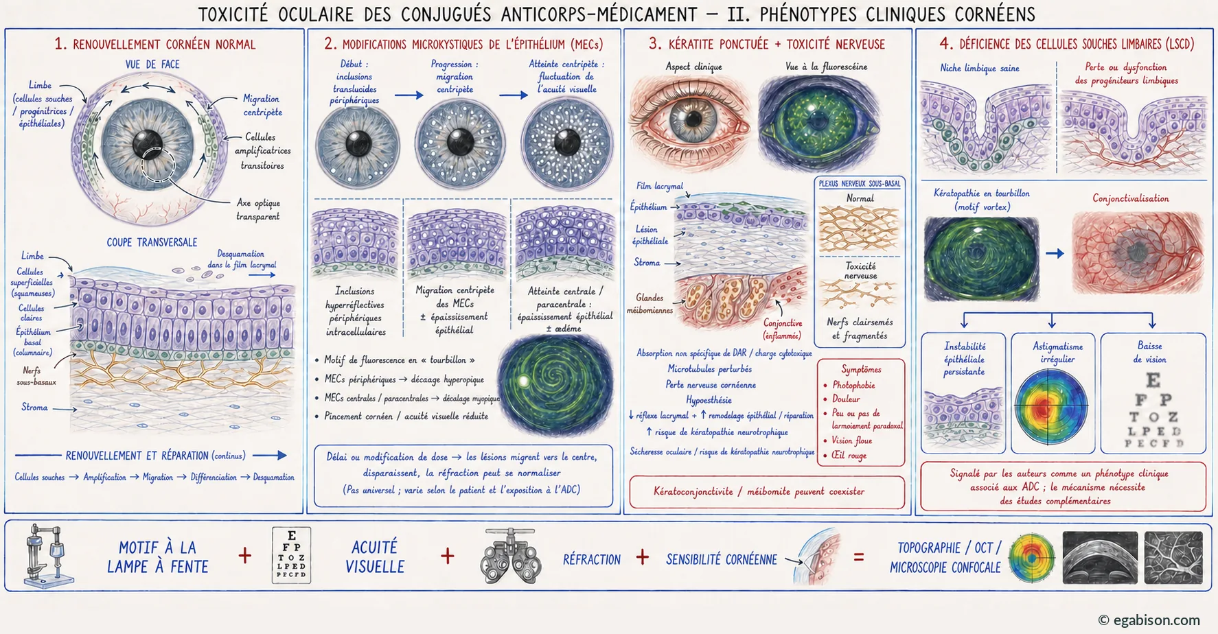 Planche II : phénotypes cliniques cornéens, du renouvellement normal au déficit en cellules souches limbiques.