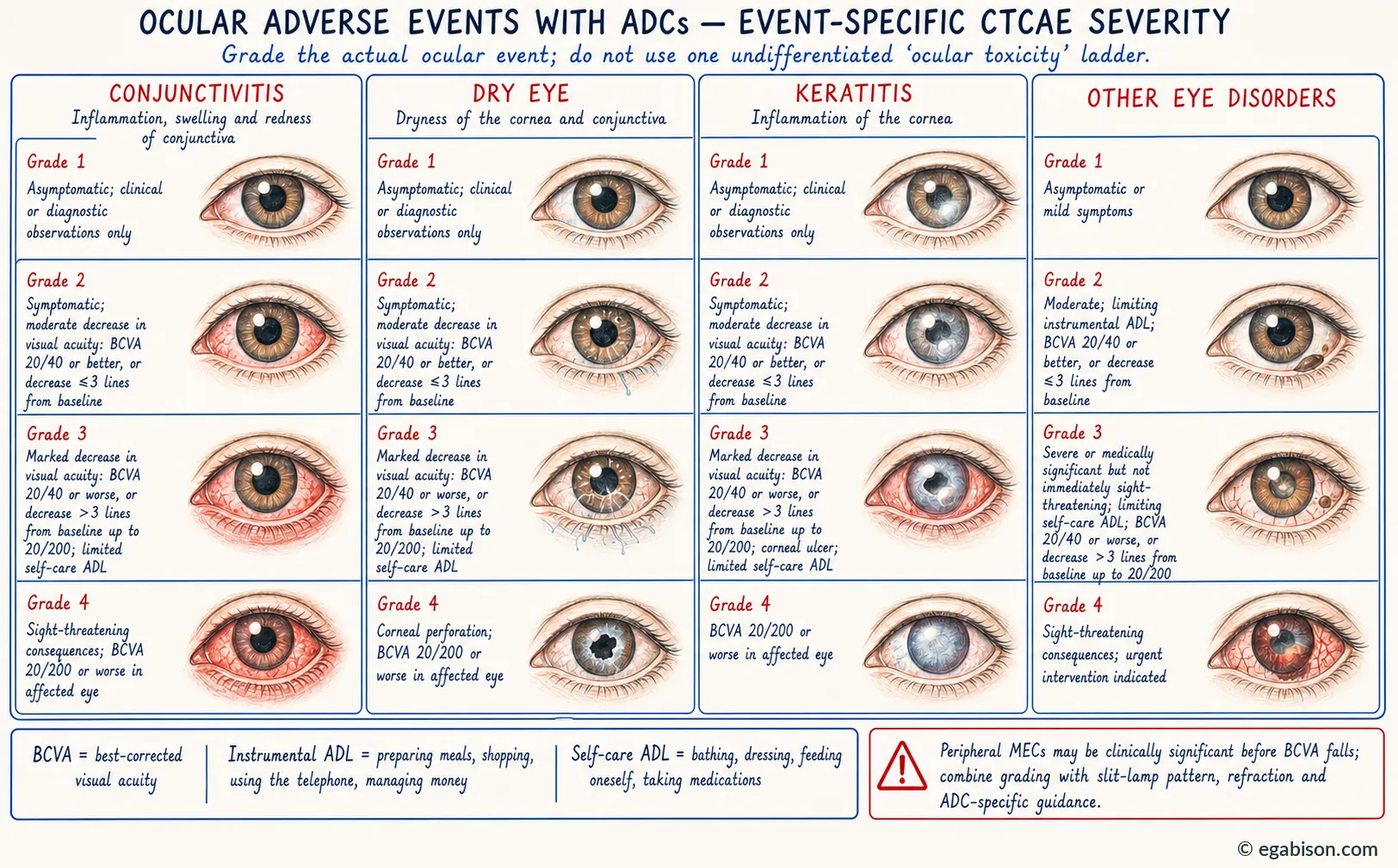CTCAE plate: event-specific grading of conjunctivitis, dry eye, keratitis and other eye disorders, grades 1 to 4.