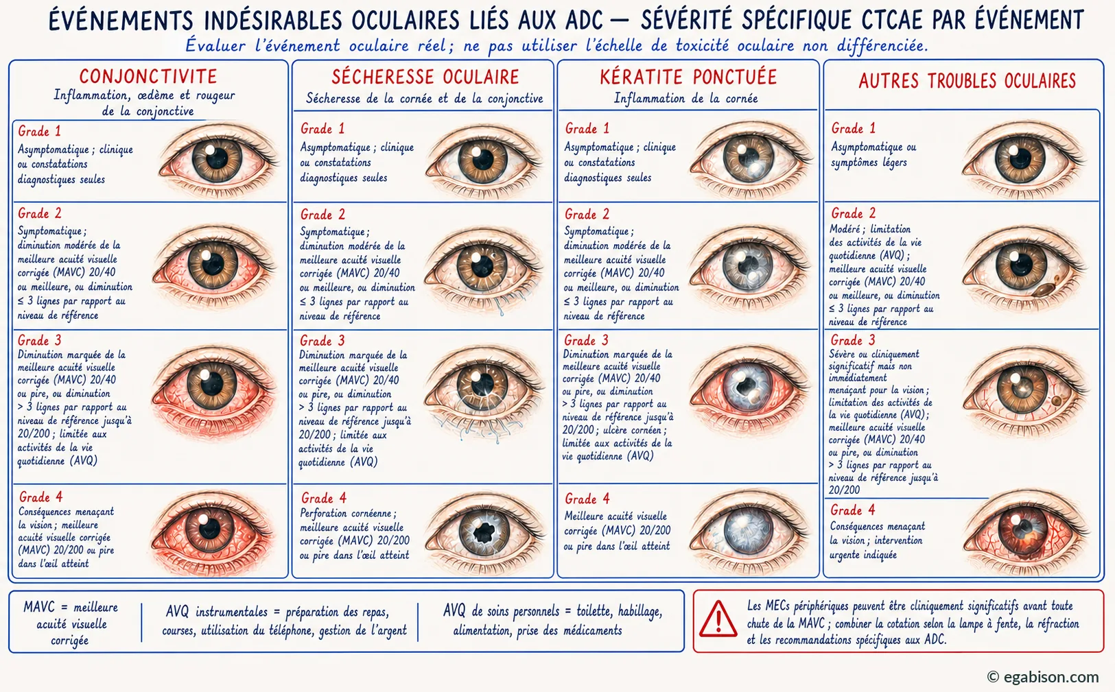 Planche CTCAE : gradation par événement, conjonctivite, sécheresse oculaire, kératite et autres affections oculaires, grades 1 à 4.