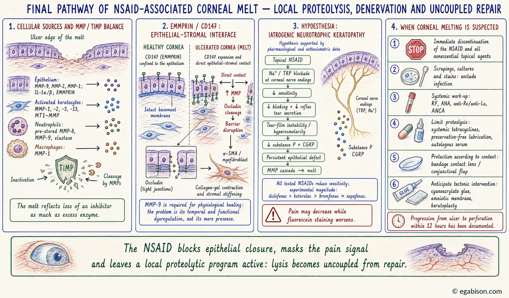 Final pathway of NSAID-related melt: cellular sources of MMPs and the MMP/TIMP ratio, the EMMPRIN/CD147 axis at the epithelial-stromal interface, the chain of induced corneal hypoaesthesia, and management of suspected keratolysis