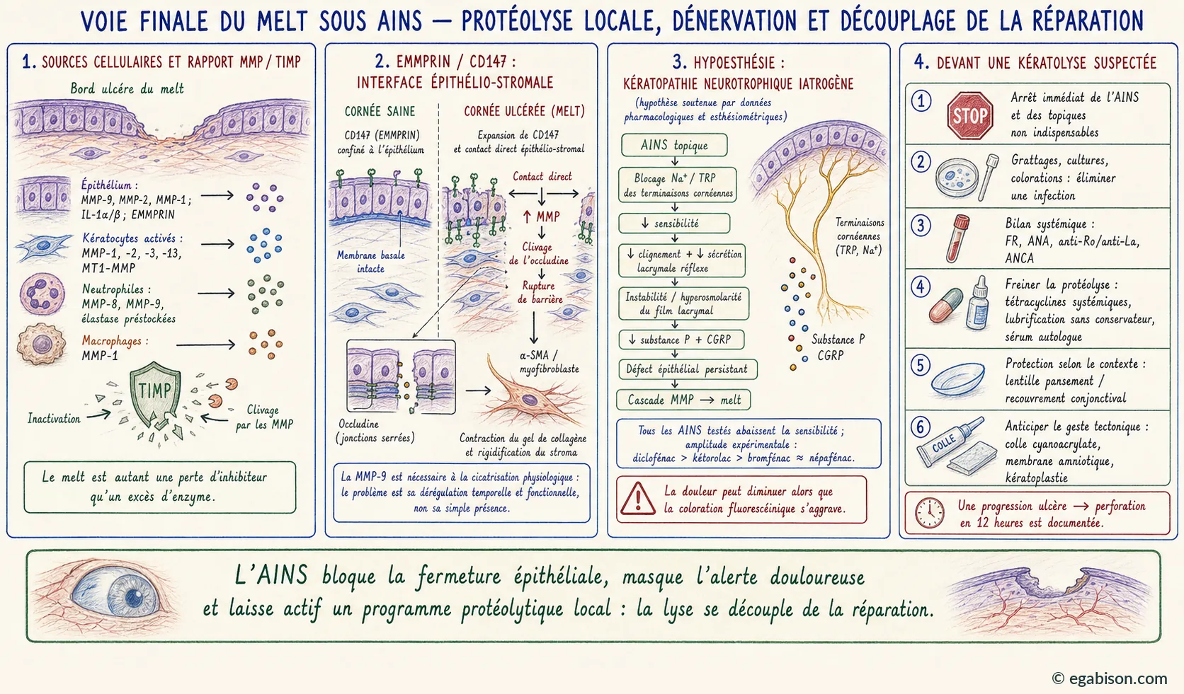 Voie finale du melt sous AINS : sources cellulaires des MMP et rapport MMP/TIMP, axe EMMPRIN/CD147 à l'interface épithélio-stromale, chaîne de l'hypoesthésie cornéenne induite, et conduite à tenir devant une kératolyse suspectée